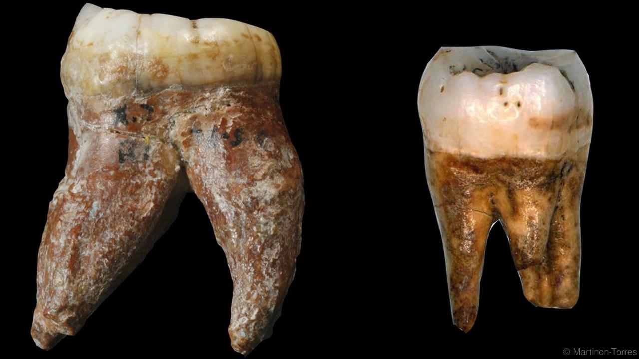teeth and human evolution